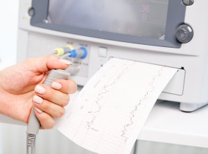 Pregnant woman performing cardiotocography CTG