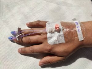 Cannula in right arm of indian man